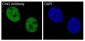 Anti-Chk2 CHEK2 Rabbit Monoclonal Antibody